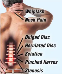  ??  ?? hiplash eck Pain ulged Disc erniated Disc ciatica inched Nerves tenosis