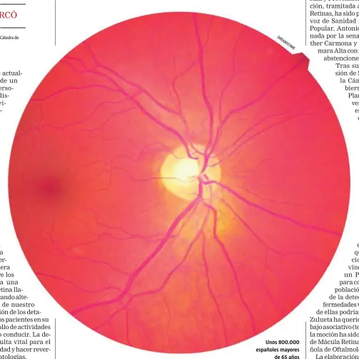  ??  ?? Unos 800.000 españoles mayores de 65 años padecen DMAE