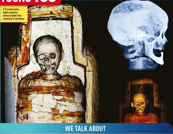  ?? ?? CT scans have been used to delve inside this mummy's remains.