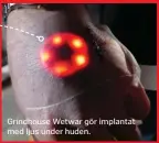  ??  ?? Grindhouse Wetwar gör implantat med ljus under huden.