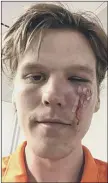  ?? Picture: Portsmouth FC ?? WAR WOUND Sean Raggett’s facial injury