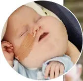  ??  ?? TREATMENT Baby Alex in hospital