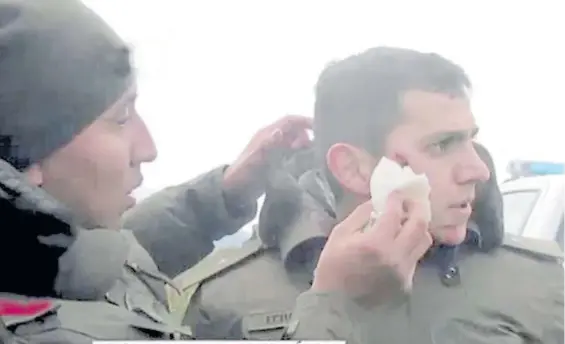  ??  ?? Herido. Uno de los gendarmes con un corte en el rostro tras recibir un piedrazo en el operativo del 1 de agosto en Cushamen.