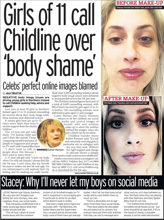  ??  ?? WORRIED Esther Rantzen Stacey reveals her black eye, poor skin and hair No black eye, flawless skin and groomed hair