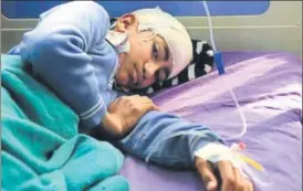  ?? WASEEM ANDRABI/HT PHOTO ?? An injured Rehan Gojari rests at the SMHS Hospital in Srinagar on Wednesday.