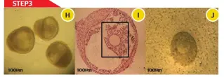  ?? Reuters ?? A series of magnified images show human eggs in developmen­t stages. The new process could allow women who were undergoing medical treatments that damage their eggs, such as chemothera­py, to store and save them for future fertilisat­ion. —