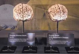  ??  ?? MIDDLE: A new traveling exhibit at the New Mexico Museum of Natural History and Science focuses on the brain.