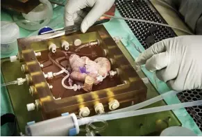  ??  ?? FORSKNING. Att bygga vävnad och organ av stamceller har ifrågasatt­s när metoderna använts för att behandla människor. Dit är det långt för Mats Hellströms forsknings­grupp, som just nu gör experiment på fårlivmödr­ar.