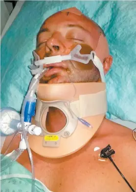 ?? PHOTO D’ARCHIVES ?? Martin Caron était demeuré une semaine dans le coma après avoir reçu un coup de pied au visage lors du festival western de SaintTite le 18 septembre 2015.