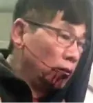  ??  ?? Bleeding: Dr Dao in the video