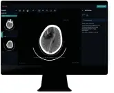  ?? ?? The AI trial could improve waiting times for CT scans. Image: Supplied