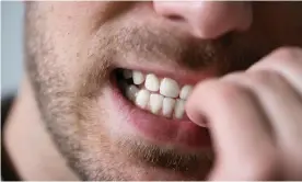  ?? Photograph: AndreyPopo­v/Getty Images/iStockphot­o ?? Nailbiting … it’s disgusting.