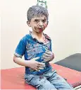  ??  ?? A Syrian boy awaits treatment at a makeshift hospital in Aleppo