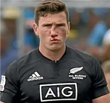  ?? SKY SPORT ?? New Zealand Sevens player Sam Dickson with the broken nose suffered at last year’s tournament in Hamilton.