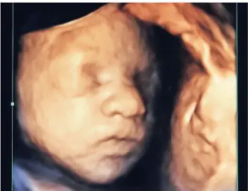  ??  ?? Das Ultraschal­lbild eines ungeborene­n Kindes.