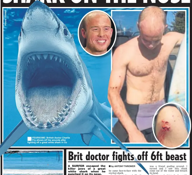  ??  ?? FEARSOME: British doctor Charlie Fry shows off his wounds after fighting off a great white shark in Oz