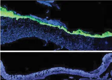  ?? CREDIT: ?? Five days after an injury to young mouse skin (blue), new skin cells (green) fill the wound (top). When researcher­s turned down expression of a protein skin cells use to talk to nearby immune cells, new skin took much longer to arrive (bottom). Image...