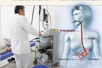  ??  ?? EXCESOS. Las endoscopía­s se encuentran entre los procedimie­ntos más sobreusado­s en el mundo.