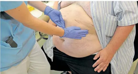  ?? FOTO: DAVID-WOLFGANG EBENER/DPA ?? Ein adipöser Patient, dem der Magen verkleiner­t wurde, zu erkennen an den feinen OP-Narben am Oberbauch, wird in der Klinik nachunters­ucht. In der Regel ist bei stark übergewich­tigen Patienten die Operation jeder herkömmlic­hen Therapie überlegen.