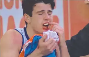  ?? Picture: FOX SPORTS ?? RISKY BUSINESS: Fremantle Docker Andrew Brayshaw points to his bloodied teeth after being hit by West Coast Eagles’ Andrew Gaff.