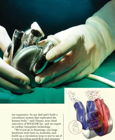  ??  ?? The spinning disc in the centre of the device is the only moving part in the new artificial heart