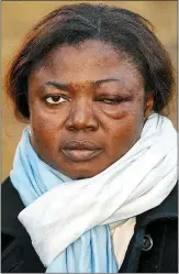  ??  ?? HURT: Sophie Amogbokpa after the assault