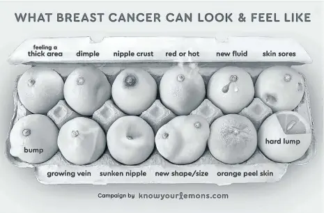  ??  ?? Worldwide Breast Cancer, “What Breast Cancer Can Look &amp; Feel Like”, © Worldwide Breast Cancer, 2017. Used by permission. Knowyourle­mons.org