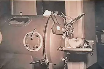  ??  ?? Lillian Weiser, Bonny Kehm’s aunt, lived in an iron lung for two years before she died in 1956. The iron lung helped people breathe after polio paralyzed their lung functions.