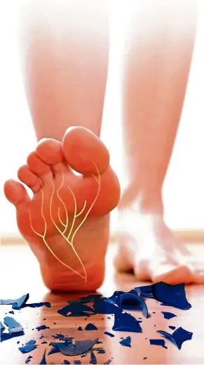  ??  ?? Nerve damage (neuropathy) is one of the results of uncontroll­ed blood sugar levels in diabetes. — 123rf.com