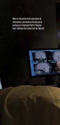  ??  ?? Mise en situation d’une opération de stimulatio­n cérébrale profonde par le professeur Stéphane Palfi à l’hôpital Henri-Mondor de Créteil (Val-de-Marne).