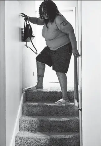  ?? ANDREA MORALES PHOTOS/FOR THE WASHINGTON POST ?? Tamika Capone, who had weight-loss surgery in Tijuana, Mexico, and returned with a rare and potentiall­y deadly antibiotic-resistant infection, has trouble navigating the stairs in her home.