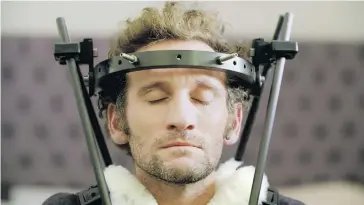  ??  ?? “The halo is like a medieval torture device,” Tim Don’s doctor said. “It’s pure torture.” Don wore it for three months after he was struck by a utility vehicle while riding his bike..