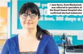  ??  ?? &gt; Jane Eyres, from Blackwood, was referred to specialist­s at the Royal Gwent Hospital who confirmed she had melanoma