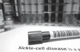  ?? IStockphot­o ?? Sickle cell disease affects about 100,000 people in the U.S., according to the Centers for Disease Control and Prevention. The two most common forms are sickle cell anemia and thalassemi­a.