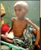  ??  ?? This picture taken on August 29, 2011 shows a sick and malnourish­ed child from southern Somalia on a hospital bed at the Banadir Hospital in Mogadishu.(afp)