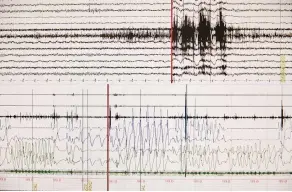  ?? ?? De arriba abajo, cama en la Unidad del Sueño del Hospital Vall d’Hebron, en Barcelona; registro de uno de sus pacientes, y Odile Romero, jefa de la Sección de Neurofisio­logía y una de las responsabl­es de este centro.