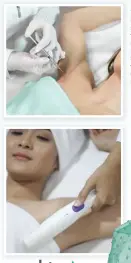  ??  ?? TAMPIL PEDE: Bau yang kurang sedap dari tubuh tentu mengganggu aktivitas. Untuk mengatasin­ya, Skin A memiliki treatment botox (foto atas) dan photothera­py.