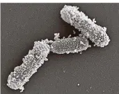  ?? FOTO: UNIKLINIK
DUISBURG-ESSEN ?? Diese Aufnahme zeigt, dass sich Nanopartik­el aus Lebensmitt­eln an Darmbakter­ien anheften. Das haben jetzt erstmals deutsche Forscher nachweisen können.