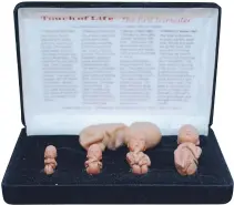  ??  ?? Un modelo a escala mentiroso El lobby antiaborto presentó una maqueta de fantasía en la que el embrión de una semana de gestación aparece con todos sus rasgos definidos.