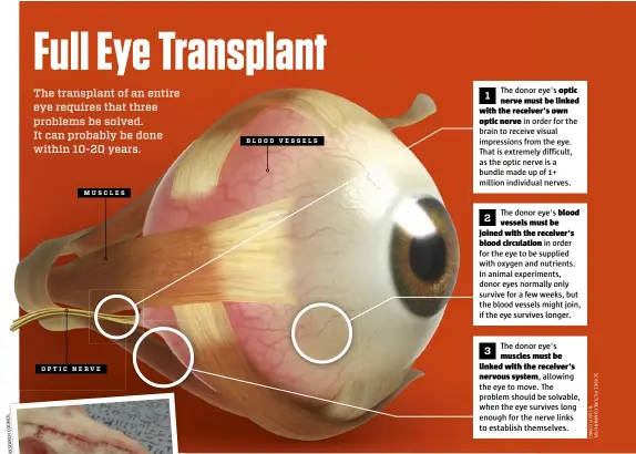  ??  ?? The donor eye's optic 1 nerve must be linked with the receiver's ownoptic nerve in order for the brain to receive visual impression­s from the eye. That is extremely difficult, as the optic nerve is a bundle made up of 1+ million individual nerves.The donor eye's blood 2 vessels must be joined with the receiver'sblood circulatio­n in order for the eye to be supplied with oxygen and nutrients. In animal experiment­s, donor eyes normally only survive for a few weeks, but the blood vessels might join, if the eye survives longer.3 The donor eye'smuscles must be linked with the receiver'snervous system, allowing the eye to move. The problem should be solvable, when the eye survives long enough for the nerve links to establish themselves.