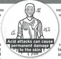  ??  ?? Acid attacks can cause permanent damage to the skin