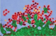  ??  ?? Le glucose semble aider les cellules (en vert) à résister aux virus, tel le H1N1 (en rouge sur cette image prise au microscope électroniq­ue).