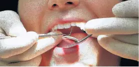  ??  ?? Your dentist will make sure that your teeth look as natural as possible