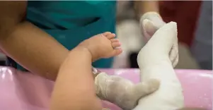  ?? ?? An infant with clubfoot being treated.