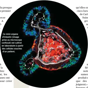  ??  ?? Ce mini-organe d’intestin (image prise au microscope confocal) est cultivé en laboratoir­e à partir des cellules souches d’un patient.