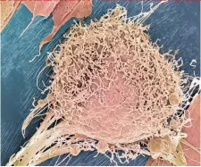  ?? ?? Z komórek macierzyst­ych szpiku kostnego (HSC) powstają wszystkie rodzaje komórek krwi. Na zdj. HSC widziana w skaningowy­m mikroskopi­e elektronow­ym.