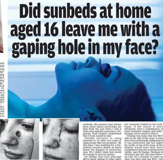  ??  ?? Shock: Gemma’s face before and after her skin cancer surgery