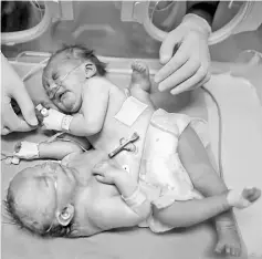  ??  ?? The day-old conjoined twins lie in an incubator at the nursery at al-Shifa Hospital in Gaza City. — AFP photo