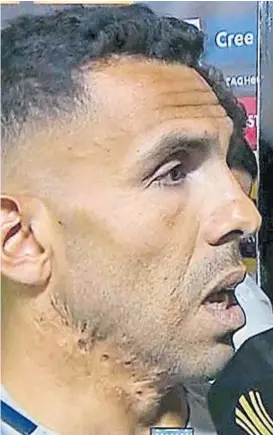  ?? (IMAGEN DE TV) ?? No hubo paz. Carlos Tevez, referente de Boca, en un día difícil.