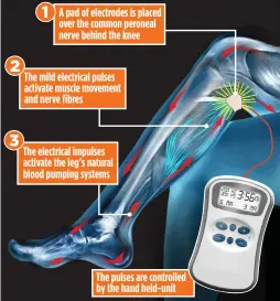  ??  ?? GOING WITH THE FLOW: How the device can help improve circulatio­n